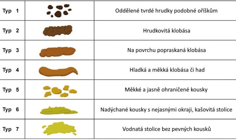 bristolská stupnia stolice